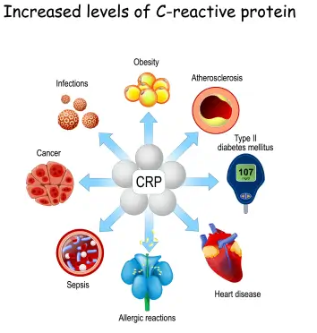 سعر تحليل CRP فى مصر واهميته فى الكشف عن الالتهابات 